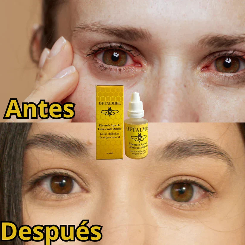 OFTALMIEL™🐝- GOTAS MÁGICAS + ENVÍO GRATIS📦