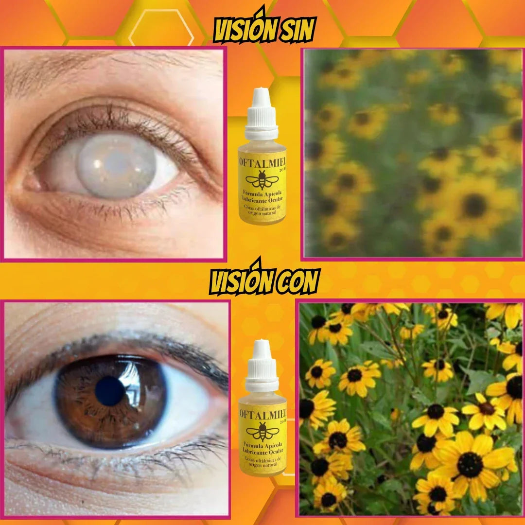 OFTALMIEL🐝Vuelve a sentir tus ojos frescos, hidratados y libres de molestias.