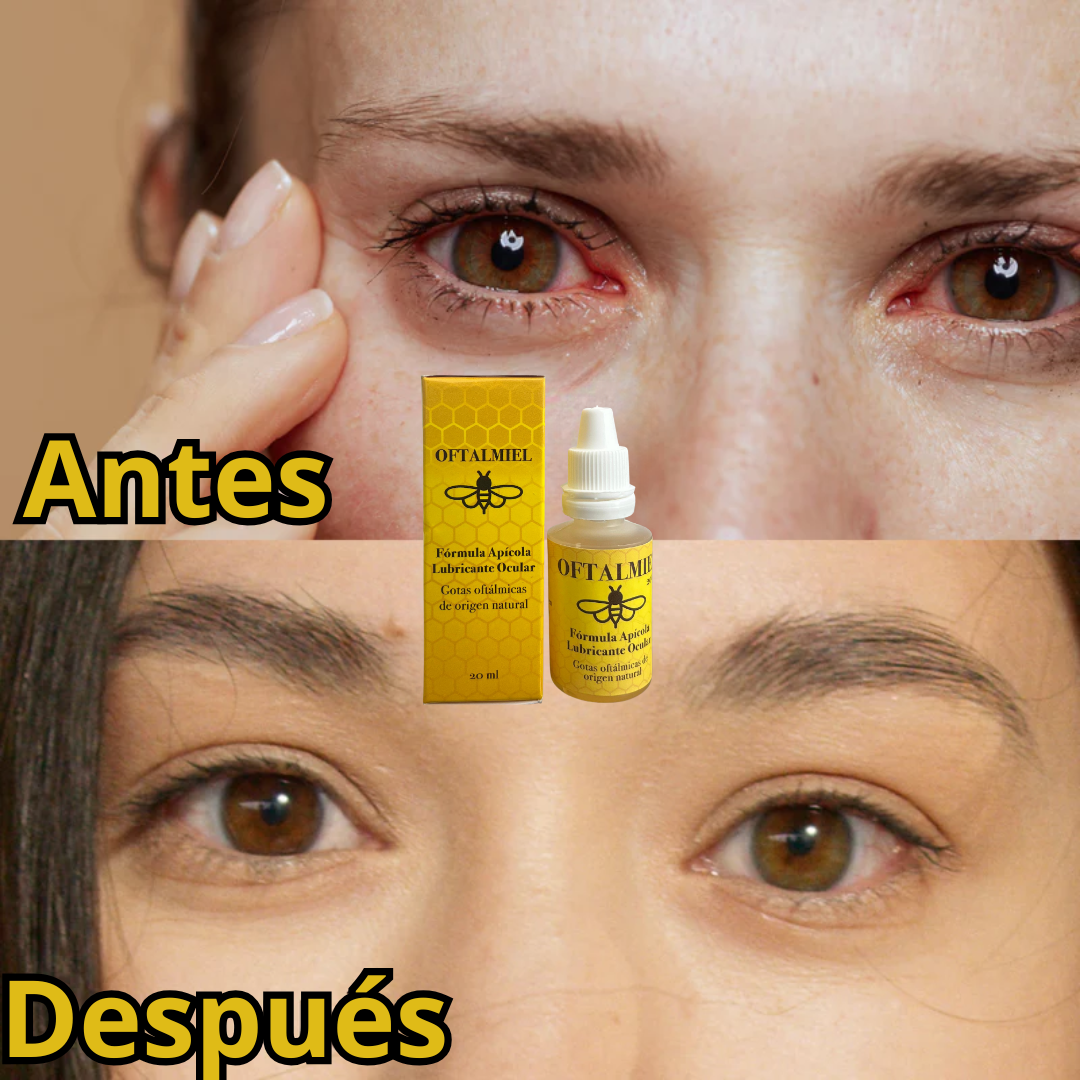 OFTALMIEL🐝Vuelve a sentir tus ojos frescos, hidratados y libres de molestias.